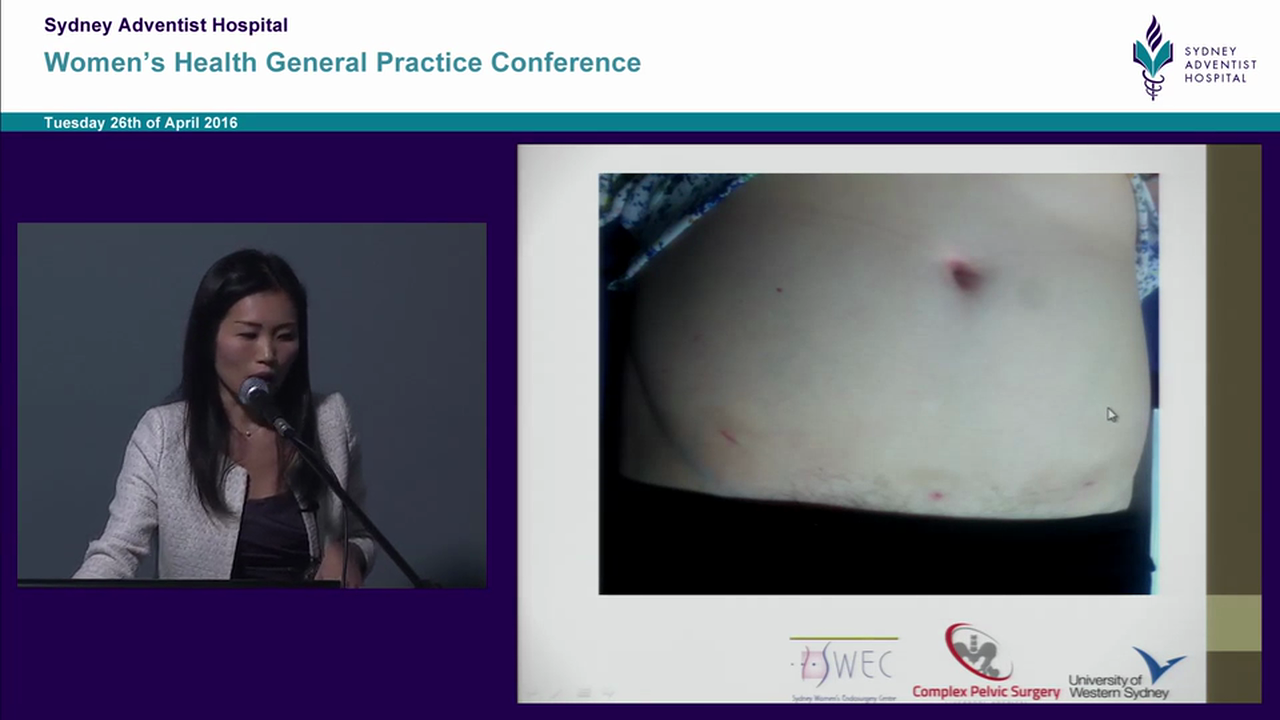 Endometriosis surgery Dr Sarah Choi