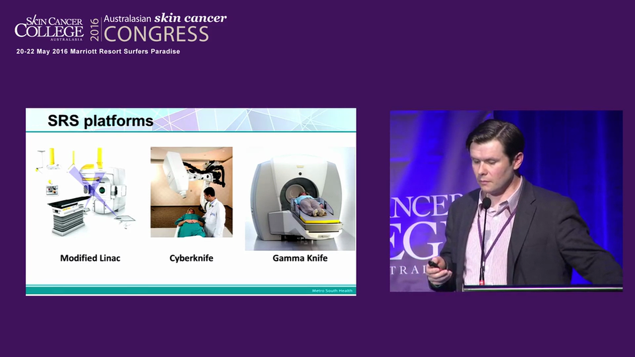 Gamma knife radiosurgery for melanoma brain metastases Mark Pinkham