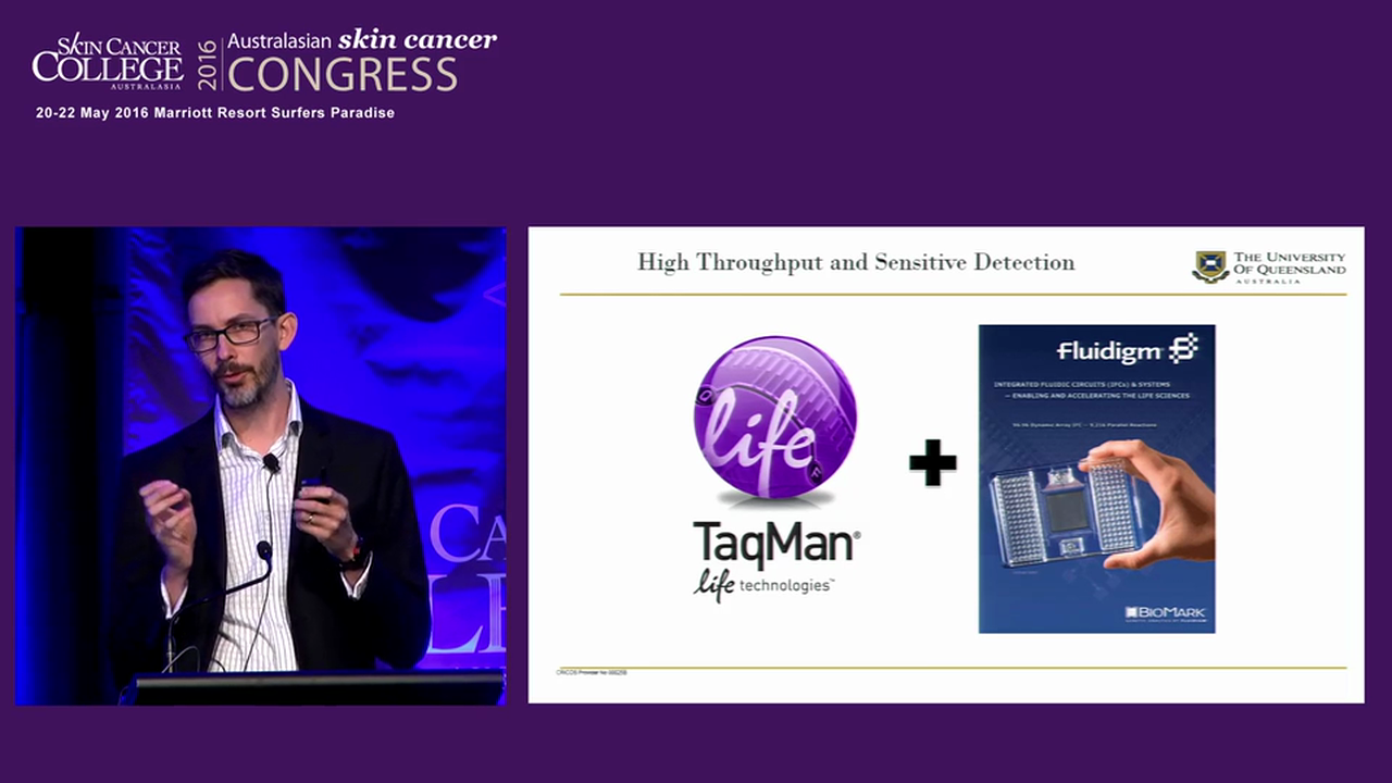 Serological tumour markers MicroRNA profiling in melanoma Mitchell Stark