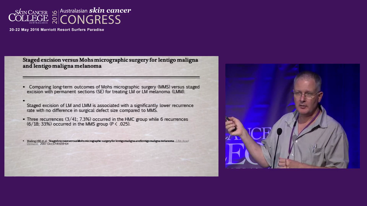 Staged 3D evaluation of lentigo maligna melanoma Franz Strydom