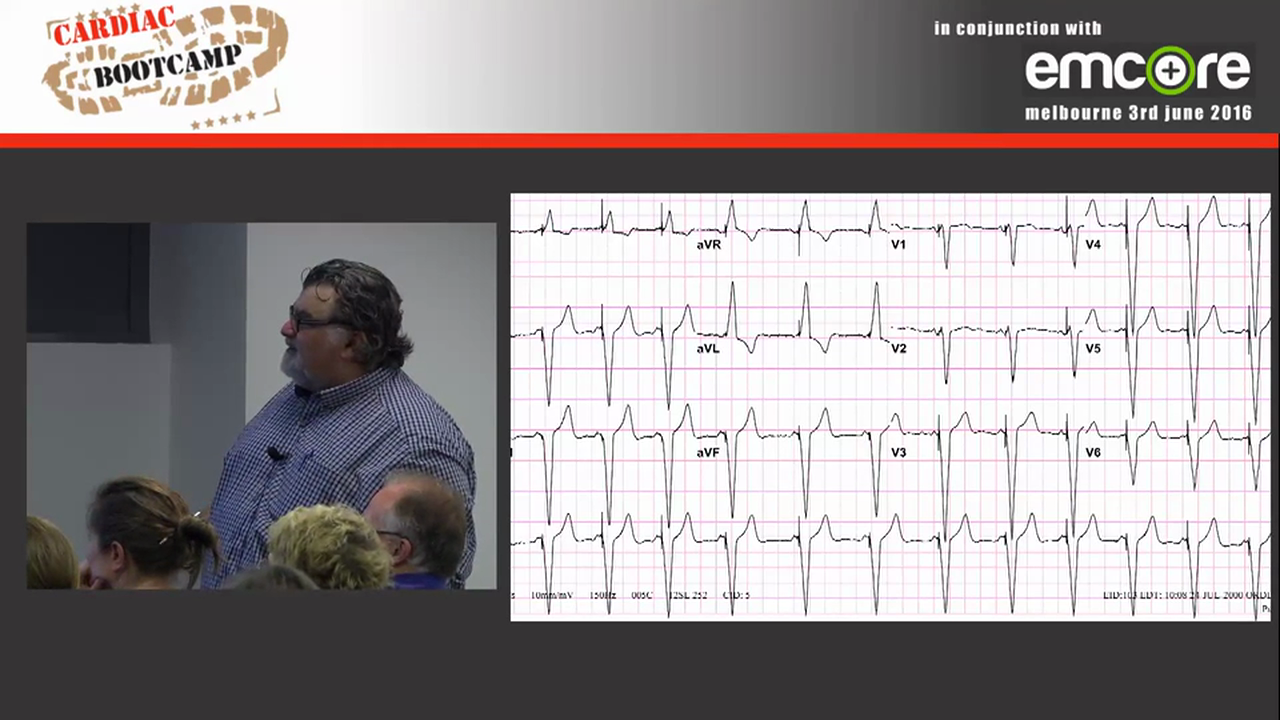 Pacing and Pacemakers A Prof Peter Kas