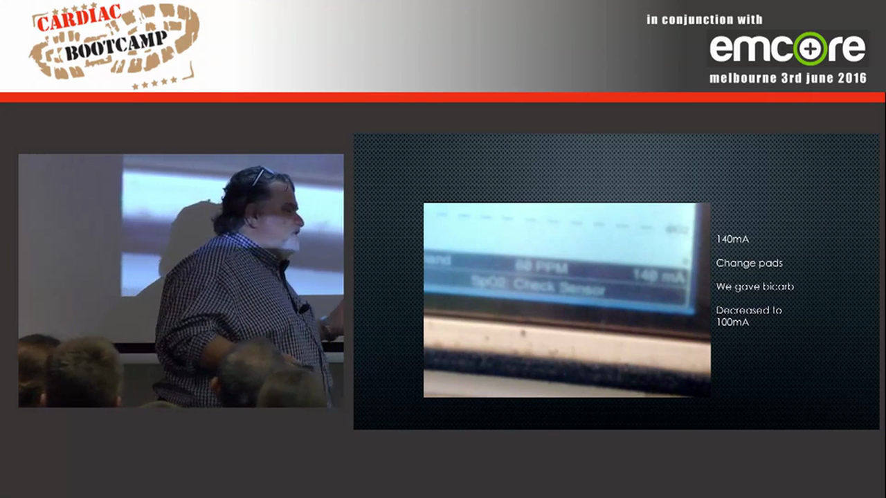 Transvenous Pacing Why and How A Prof Peter Kas