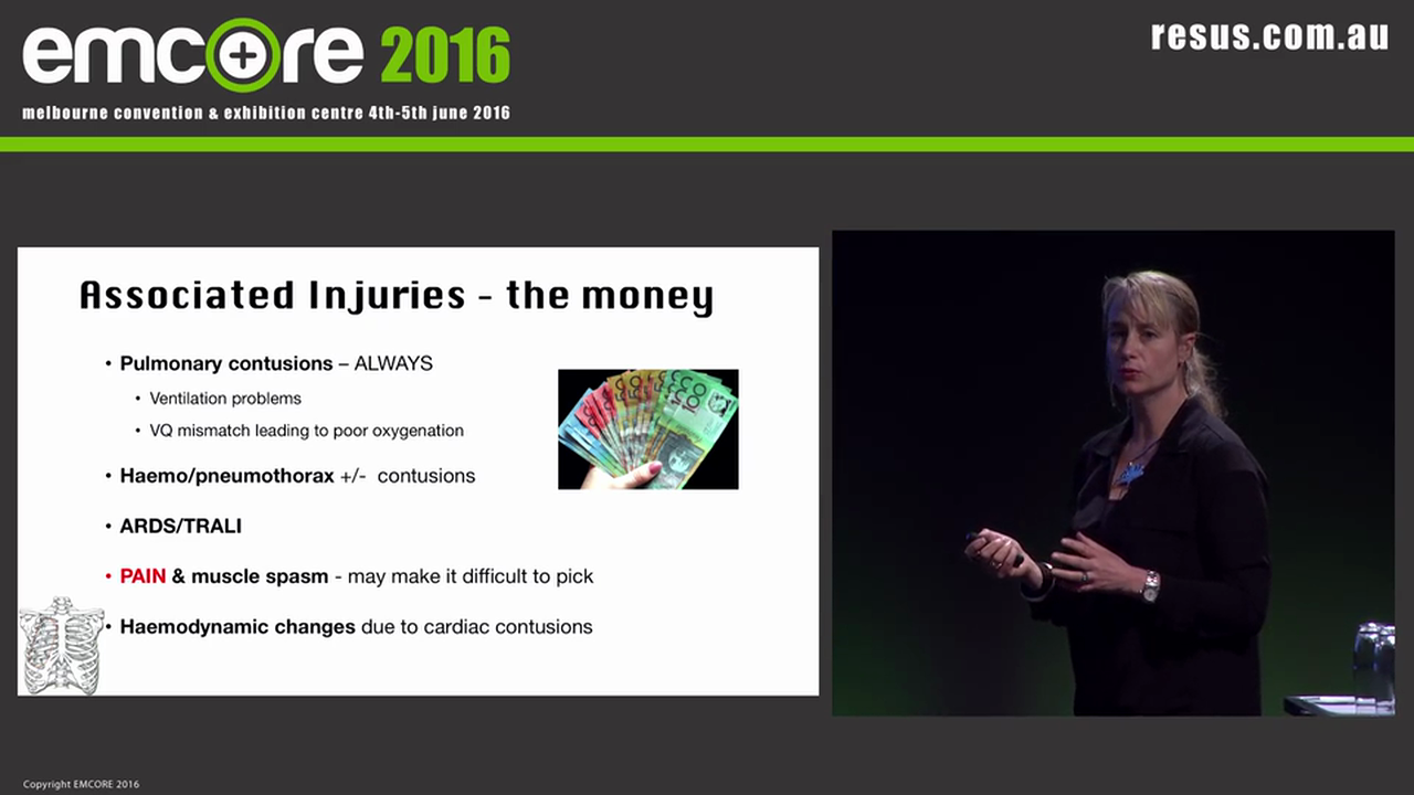 Beware the flail Chest Dr Sam Bendall