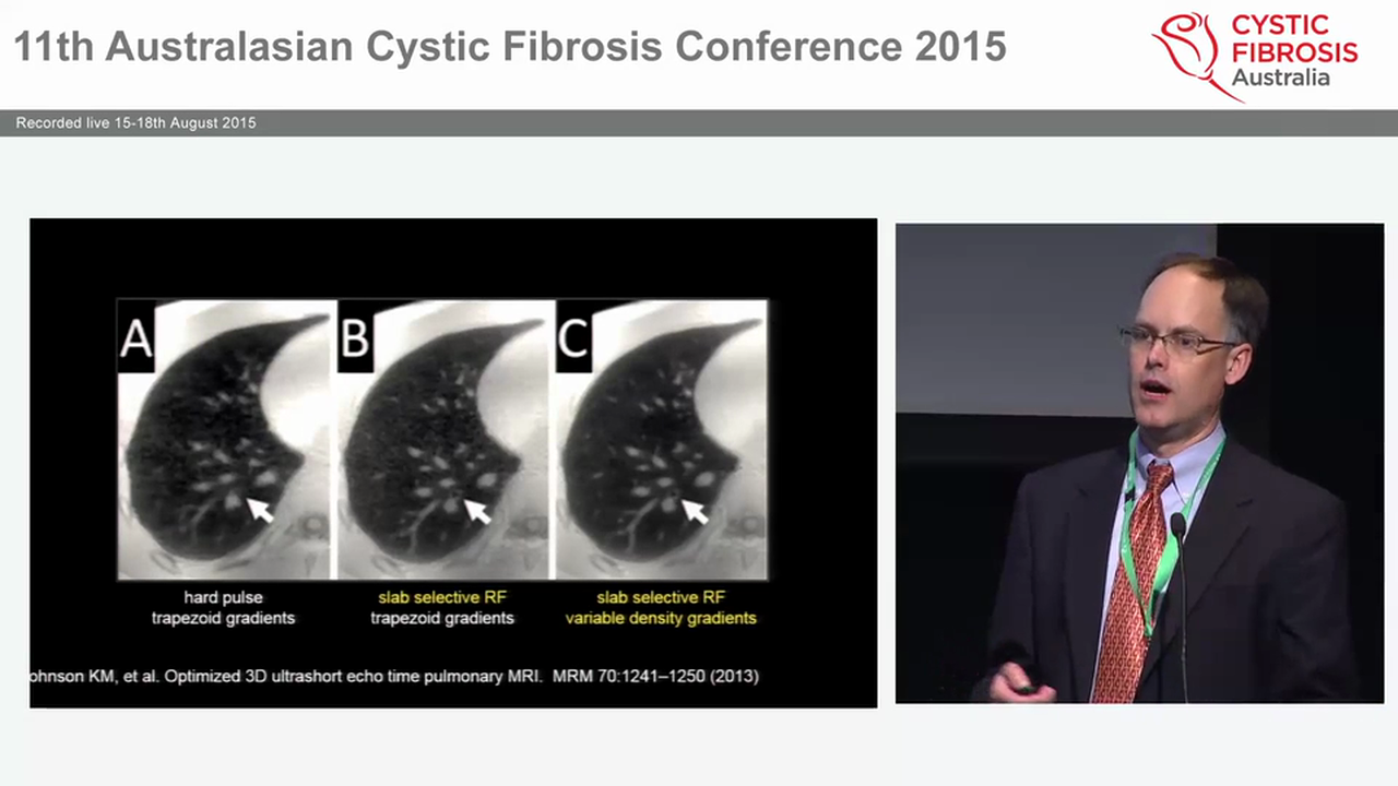 Role of MRI in Early CF Scott Nagle