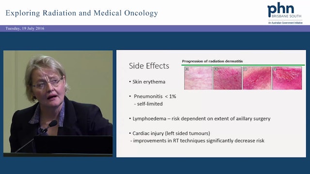 Breast Cancer Radiation and Oncology Update for GPs Assoc Prof Margot Lehman and Dr Elizabeth McCaffrey