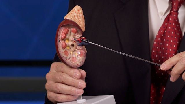 Does High Blood Pressure Hurt Kidneys?