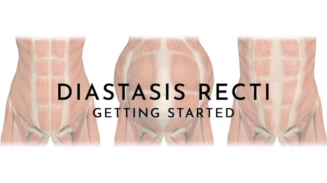 Diastasic Recti: Getting Started