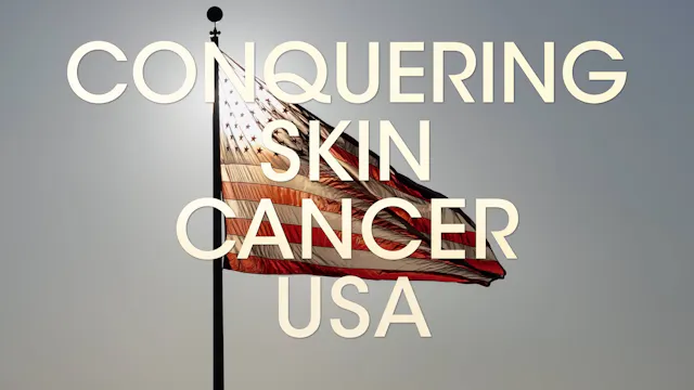 Conquering Skin Cancer USA (Feature Film - 75 minutes)