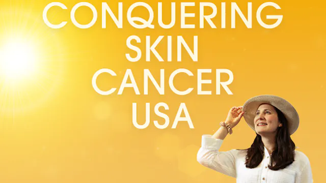 Conquering Skin Cancer - Hospitals Toolkit