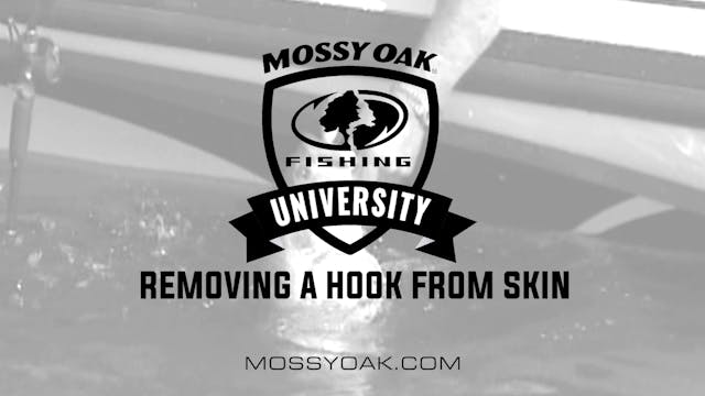 Removing a Hook From Skin • Fishing T...