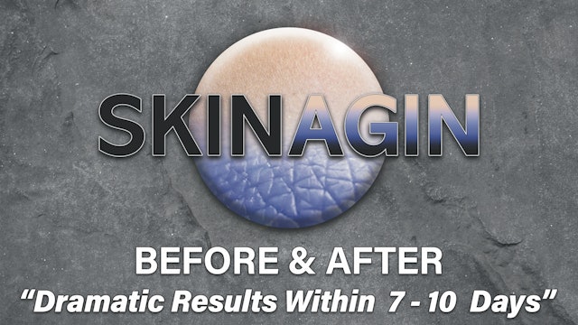 Dramatic Results Within 7 - 10 Days!