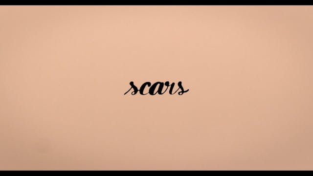 SEDICICORTO 2021 - Scars