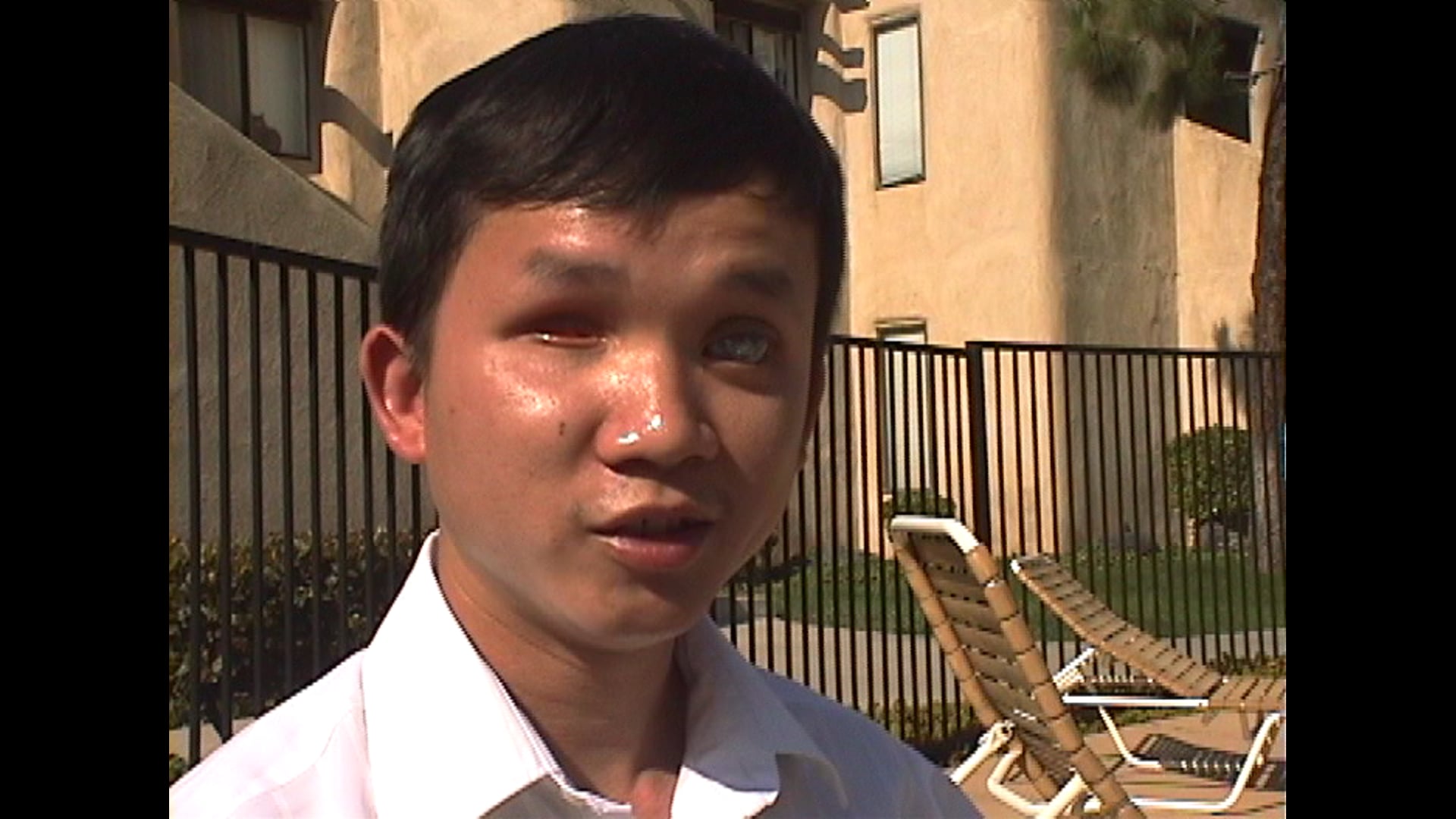 The Blindness Series - amaurosis