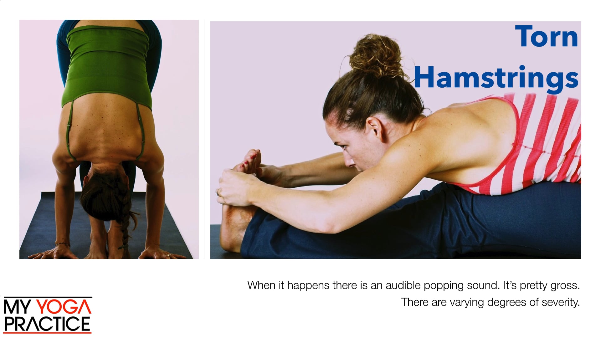 15.4- Injuries to Specific Parts of the Body 2