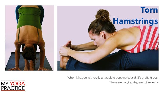15.4- Injuries to Specific Parts of t...