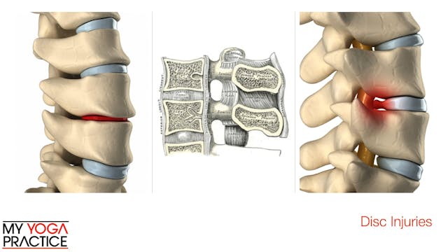 15.3- Injuries to Specific Parts of t...