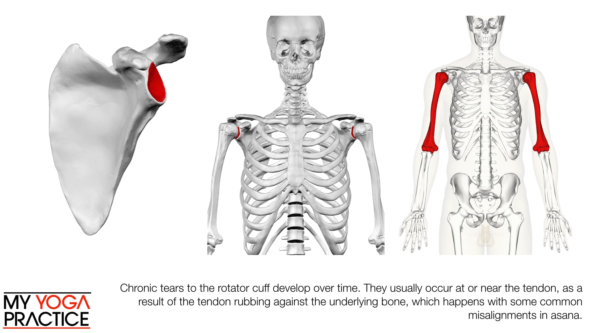 11.8- The Rotator Cuff 2