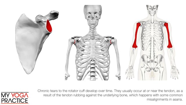 11.8- The Rotator Cuff 2