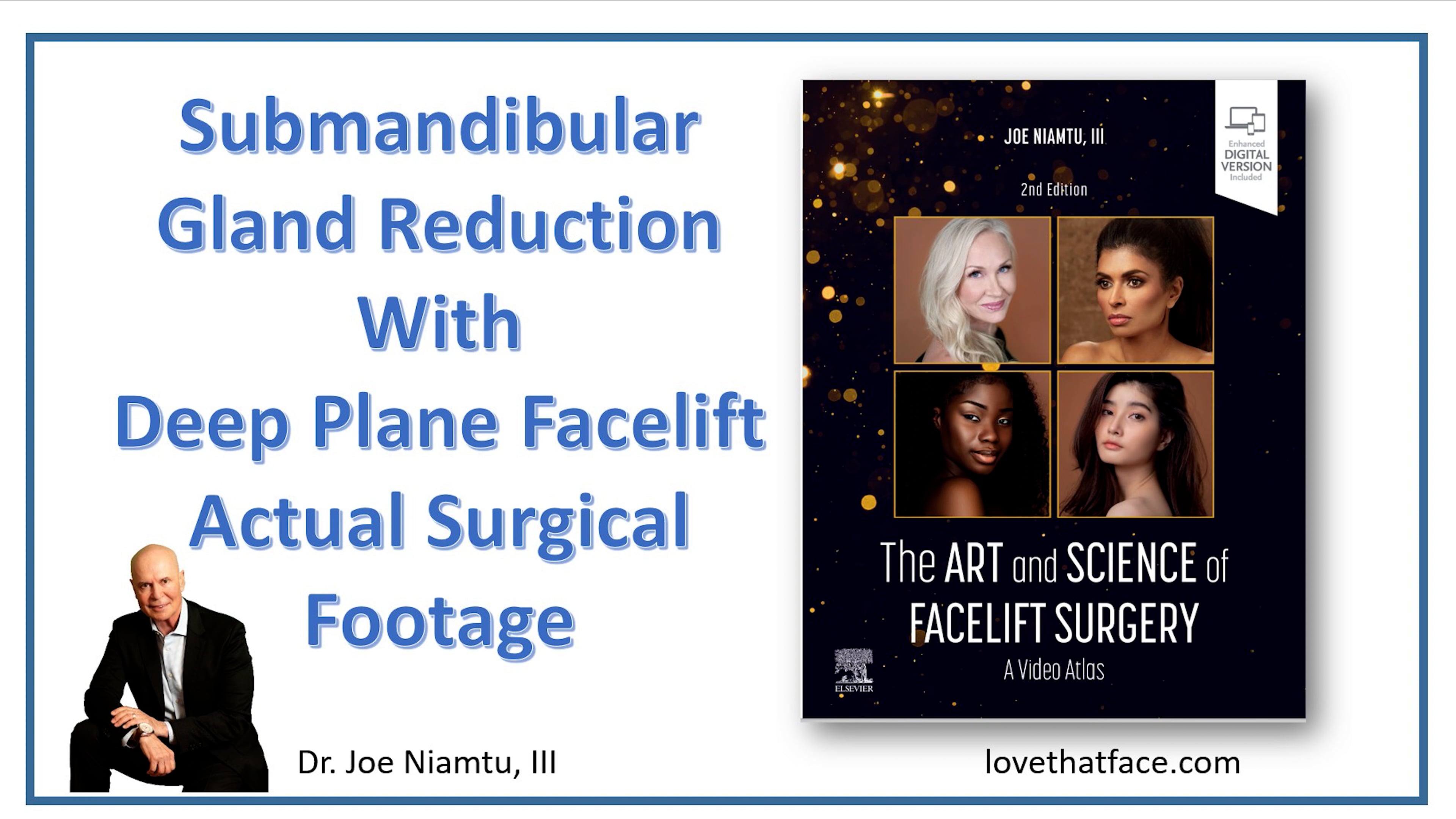 Submandibular Gland Reduction in Deep Plane Facelift