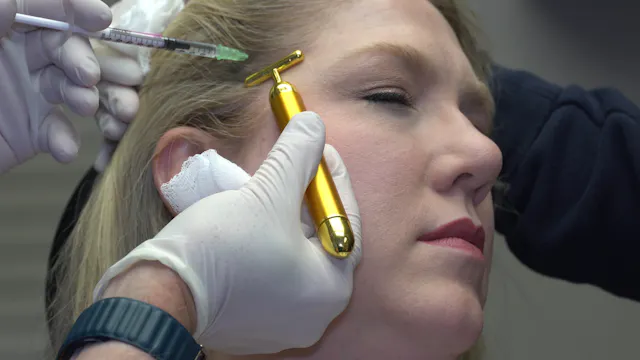 Botox to bilateral Masseter