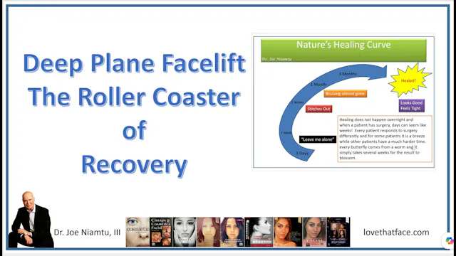 The Roller Coaster of Recovery