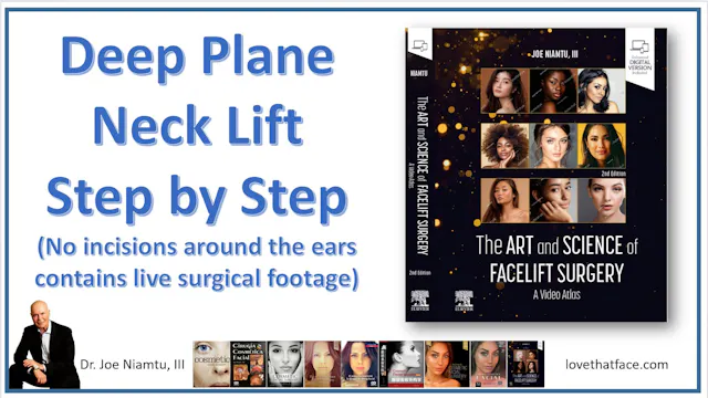 Deep Plane Neck Lift