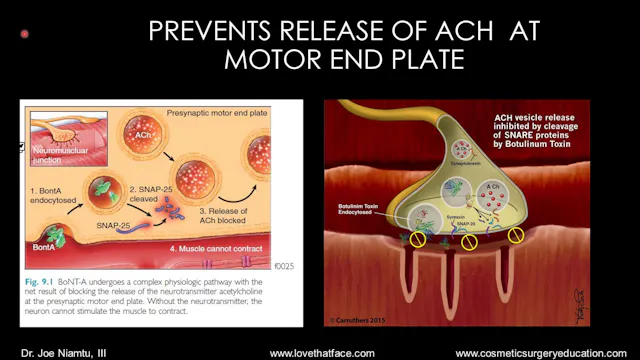 Platinum Neurotoxin (Neuromodulator) Lecture