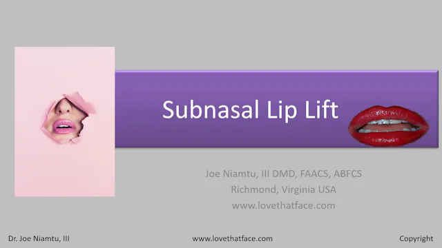 Platinum Lip Lift Lecture
