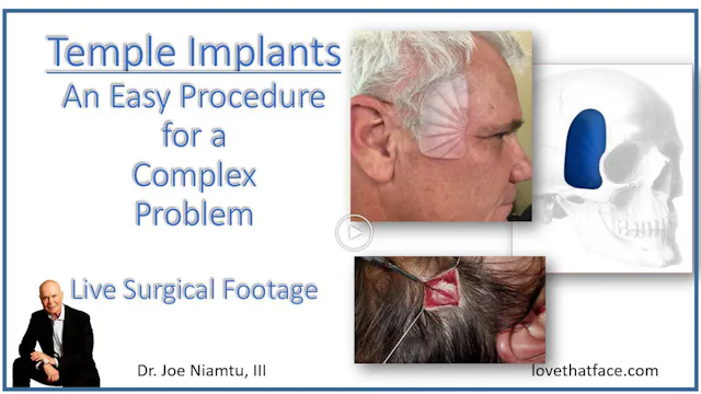 Temporal Implant