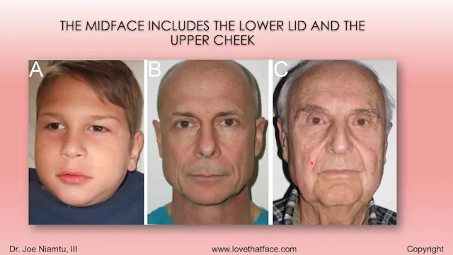 Platinum Facial Implants Lecture