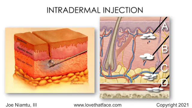 Platinum Injectable Filler Lecture