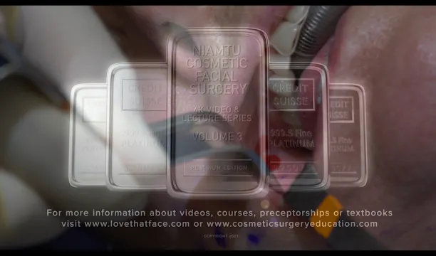 Local Anesthesia for Buccal Fat Reduction