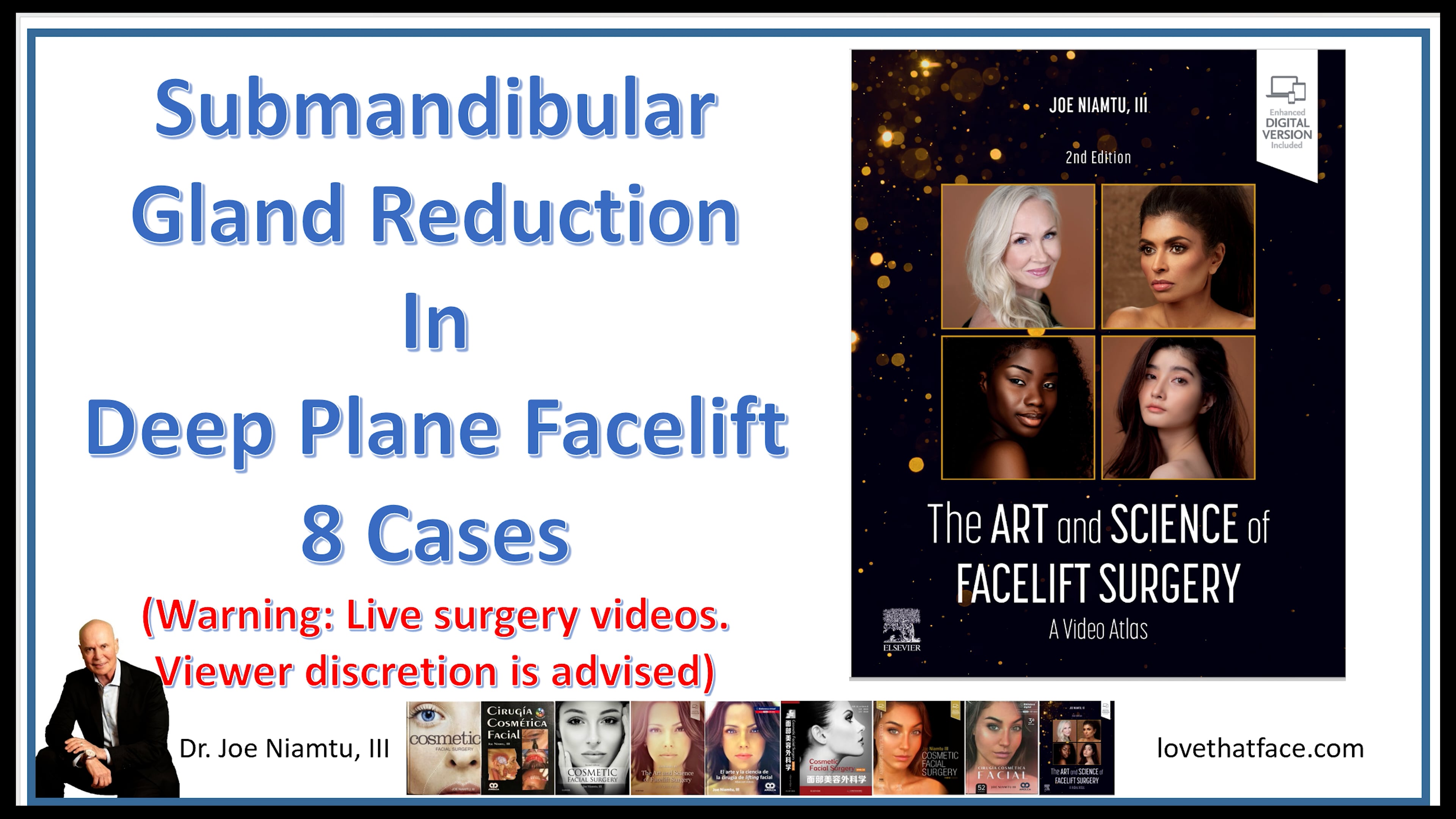 Submandibular Gland Reduction in Deep Plane Facelift : 8 Cases