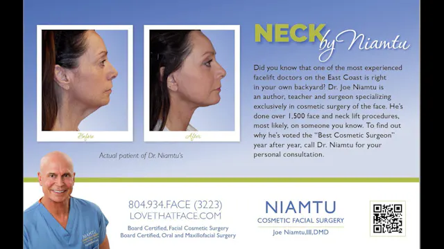 5. Digastric Muscle Reduction 2x