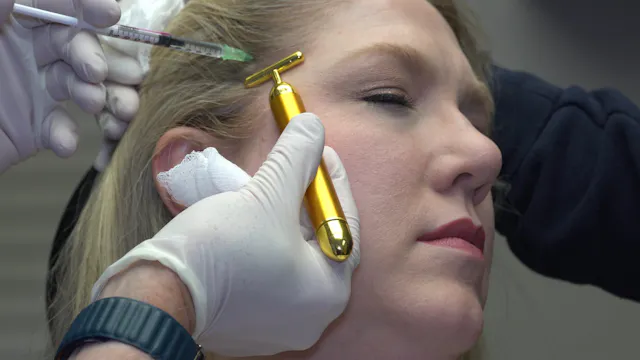 Botox to bilateral Masseter