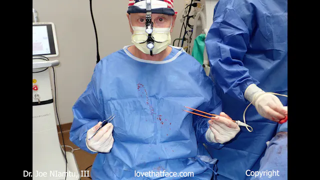 7. Submandibular Gland Reduction with Tonsil Snare and and Clamp