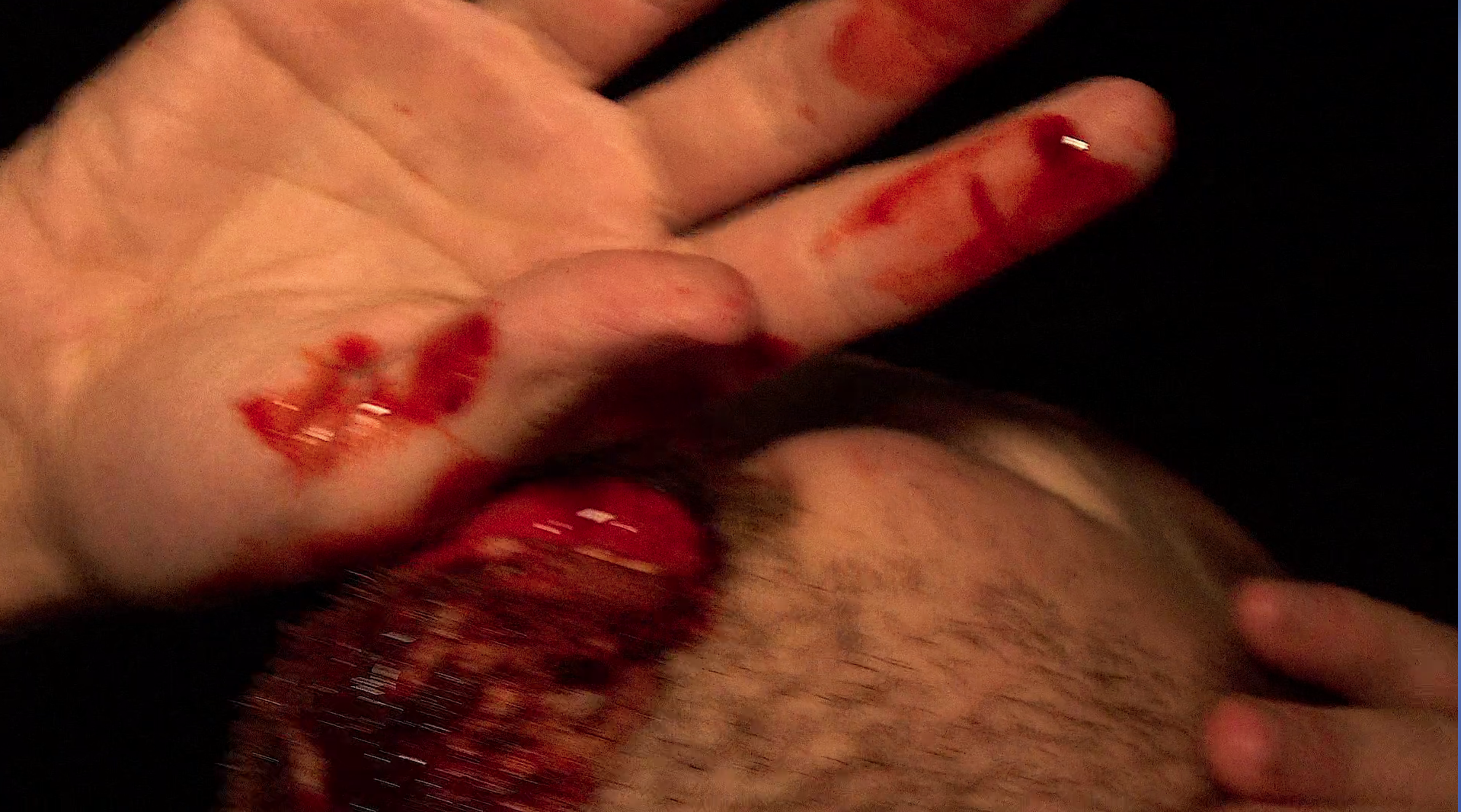 Someone is Bleeding