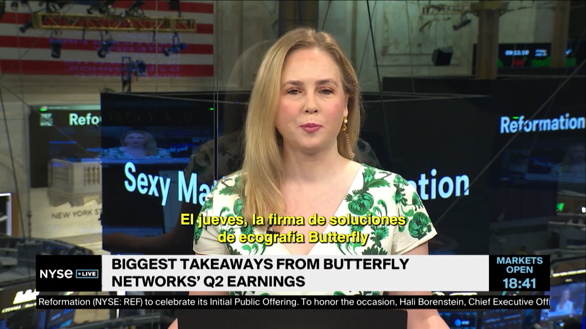 El CEO de Butterfly Network explica qué impulsó el crecimiento anual