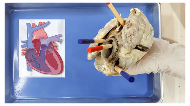 Heart Dissection  Love the Lub-Dub [EDU]