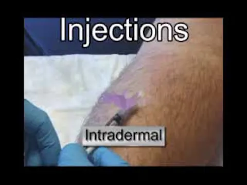 Intradermal Injection