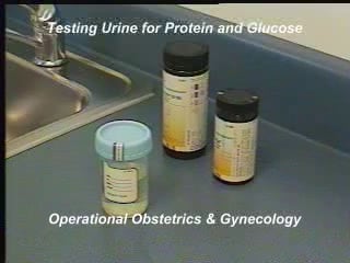 Protein and Glucose Testing of the Urine