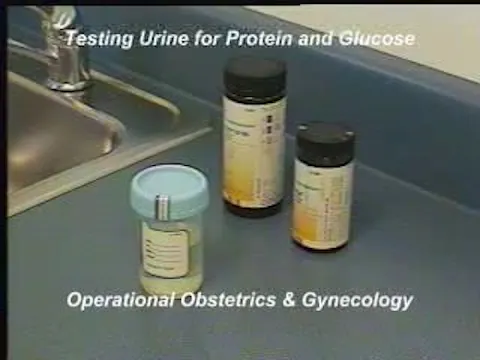 Protein and Glucose Testing of the Urine