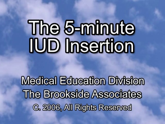 The 5-Minute IUD Insertion