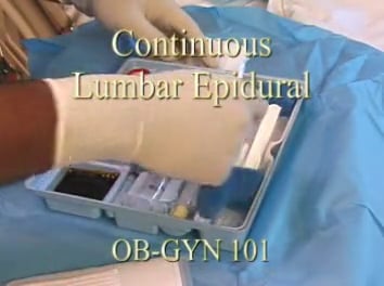 Continuous Lumbar Epidural