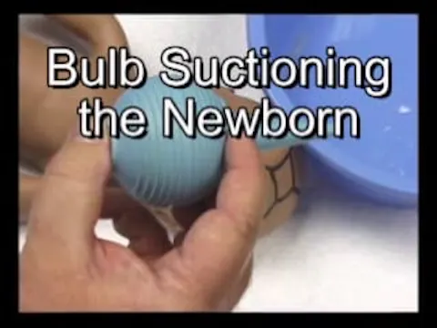 Aspiration with a bulb syringe