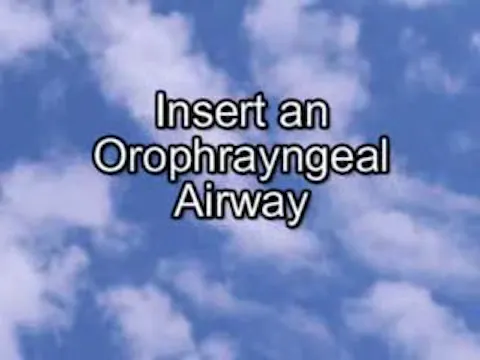 Oropharyngeal Airway
