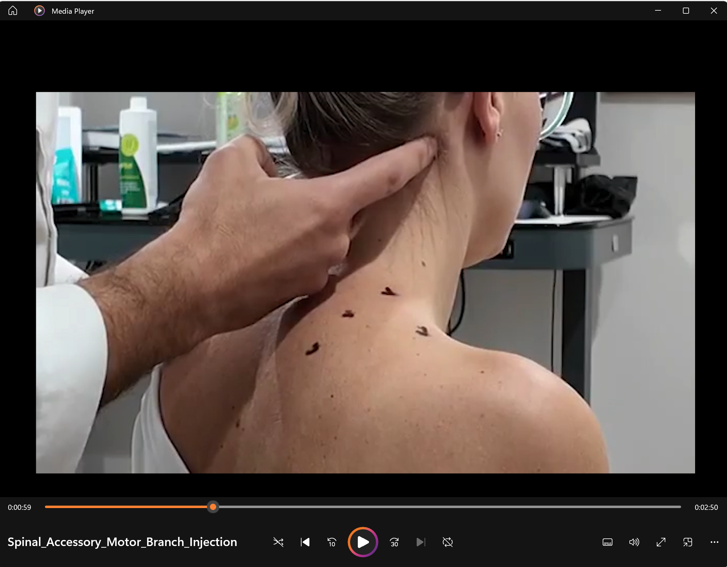 Spinal Accessory Motor Branch Injection