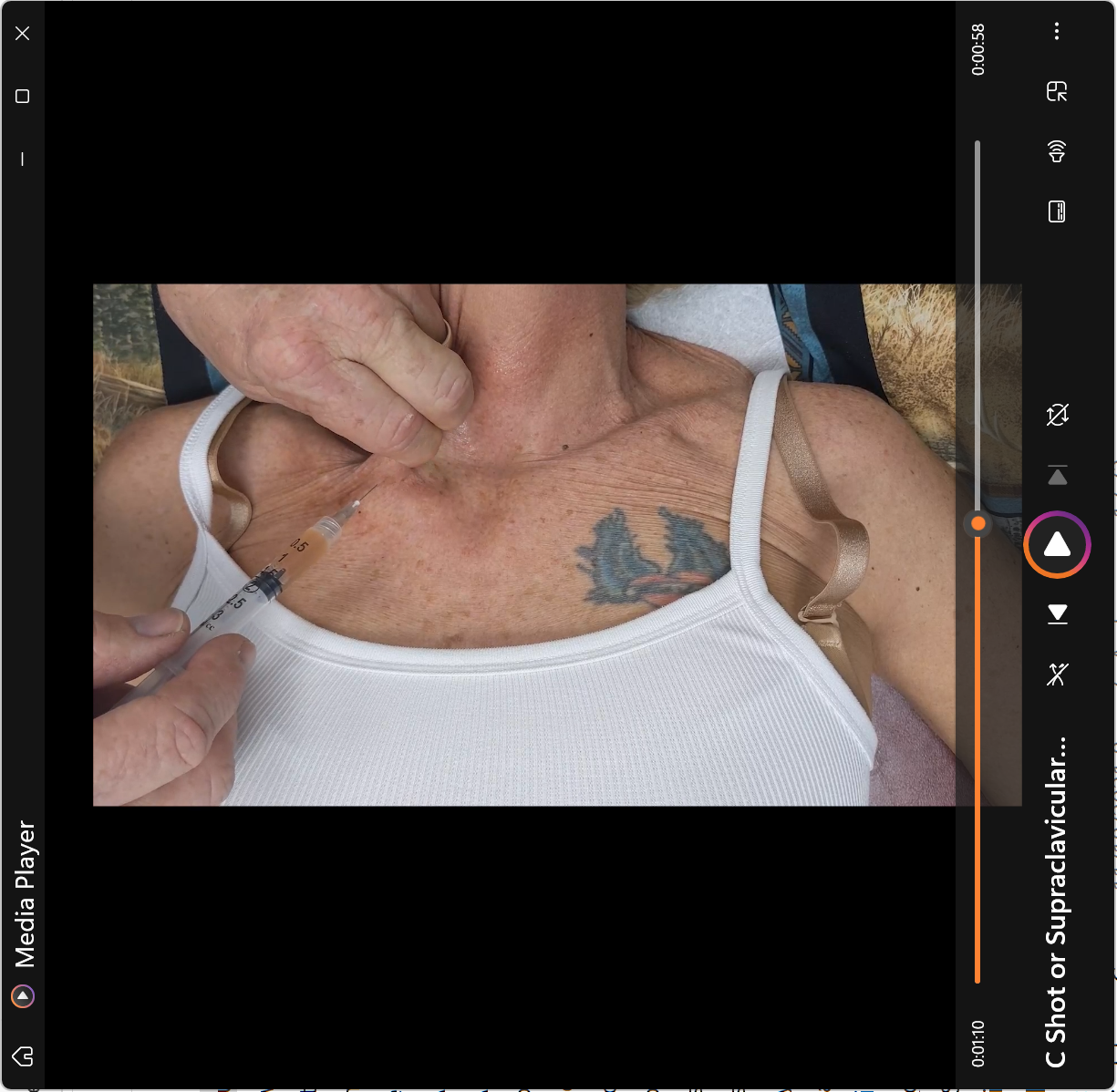 C Shot or Supraclavicular Injection into the Brown Fat