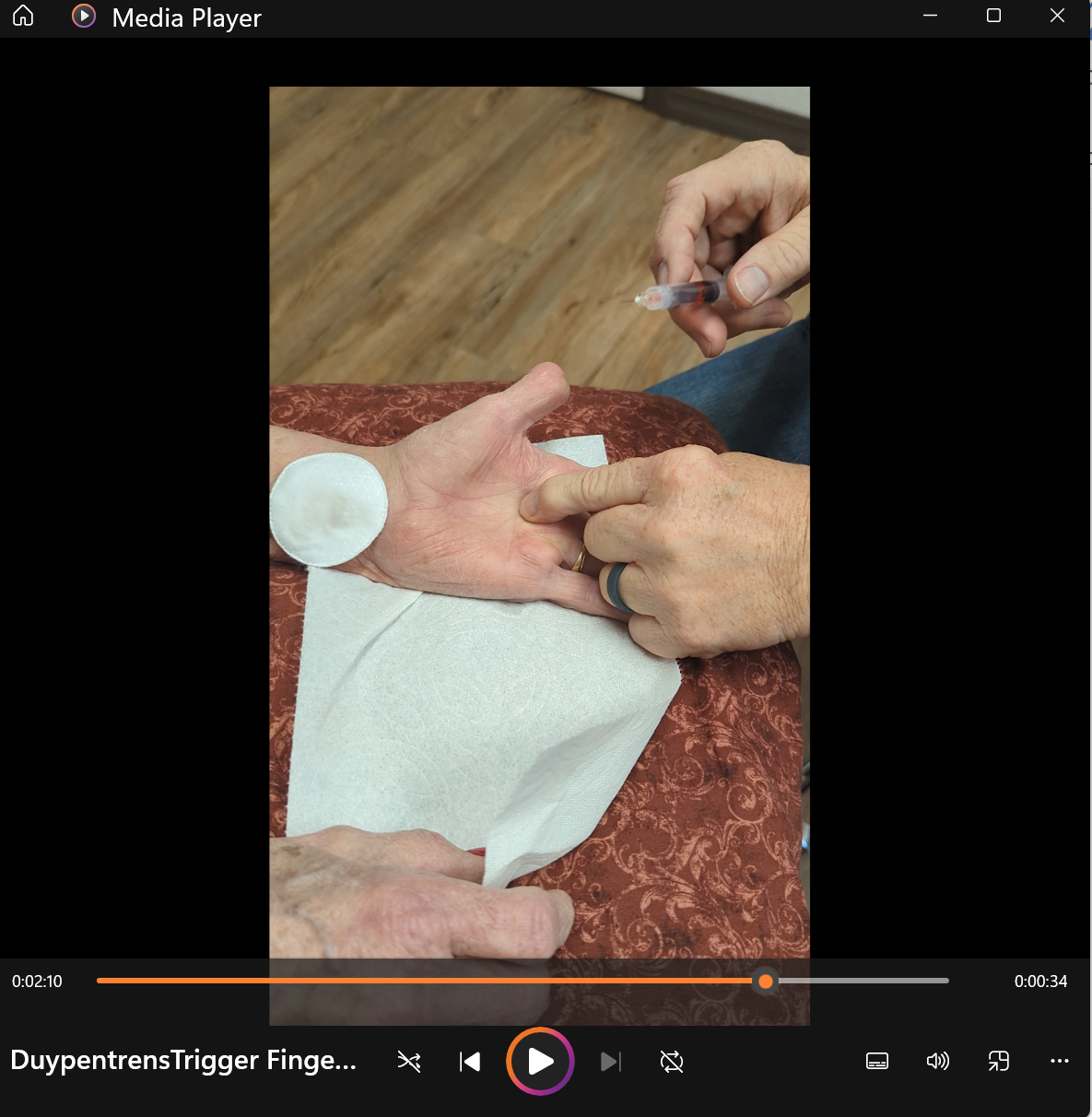 DuypentrensTrigger Finger Release Injection
