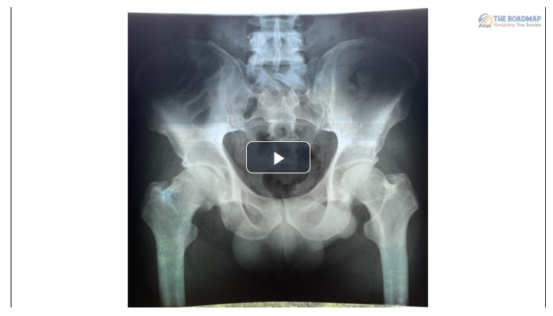 Anterior Hip Injection